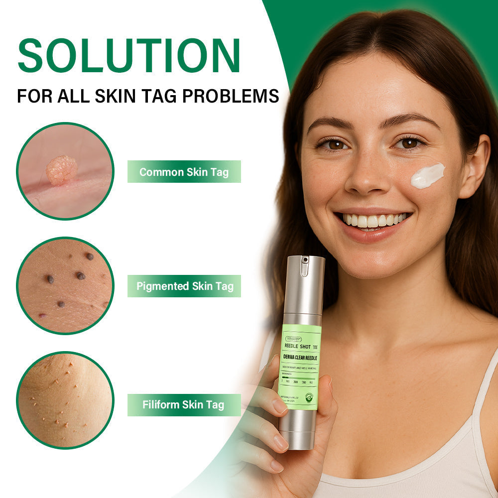 🌟 NEGUSY® USA DermaClear Precision Serum – Targeted Solution for Warts & Moles 💧