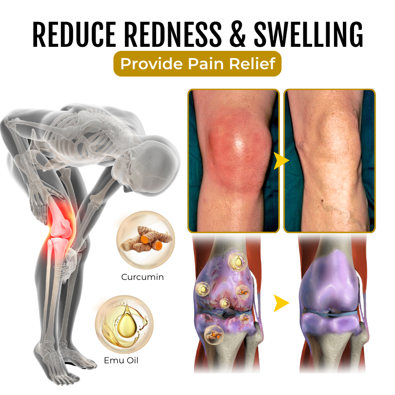 Seurico™ Turmeric & Emu Oil Joint Pain Relief Massage Gel