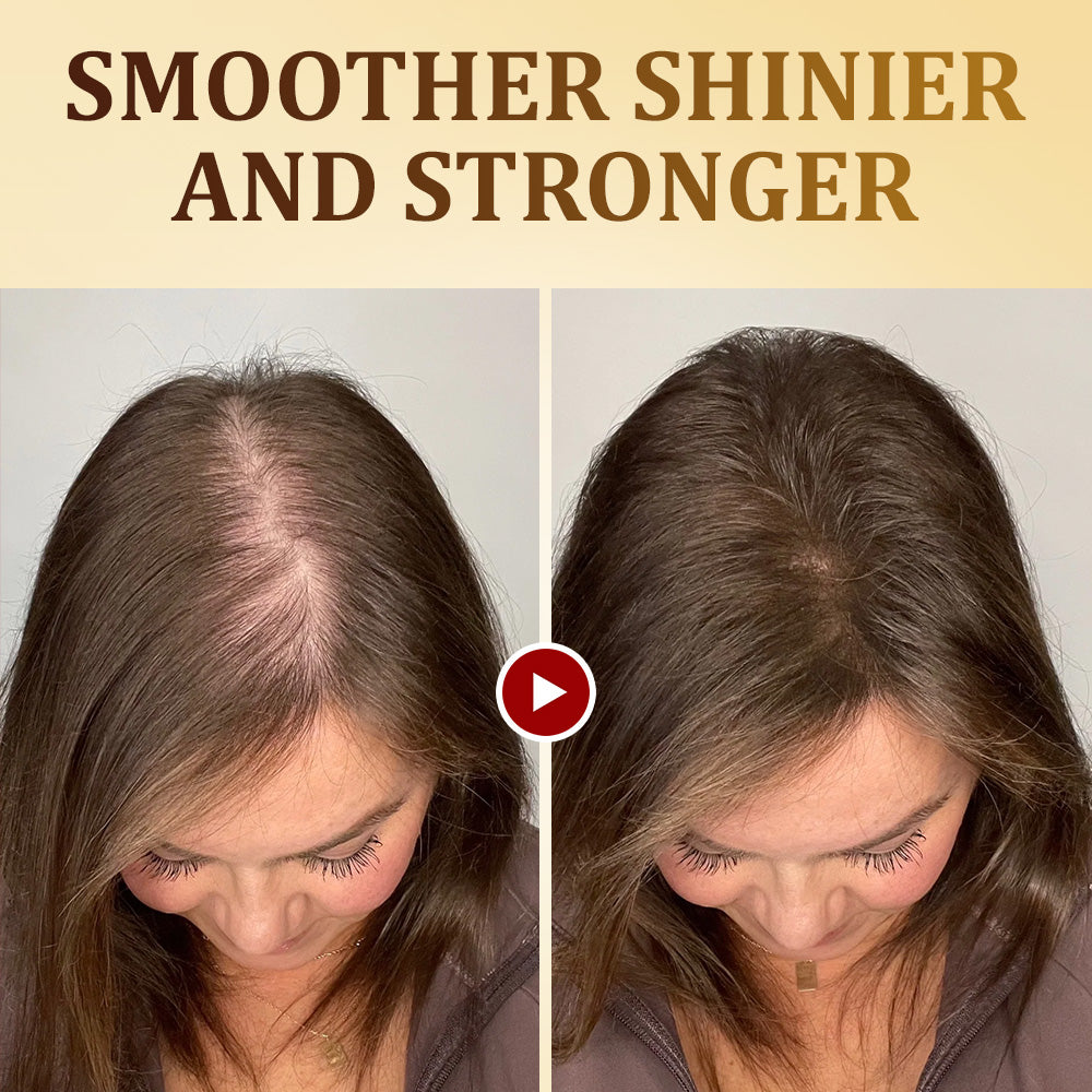 Seurico™ Ginger-Essence Hair Renewal Conditioner🌟“Ginger-Powered Repair for Hair That’s Been Through It.” 🧴🔥