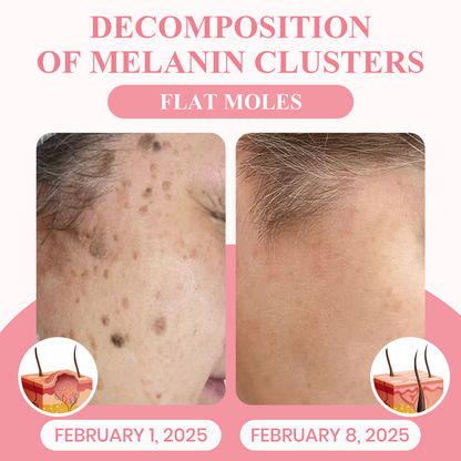 🌿 Negusy™ Dual Acid Wart & Mole Remover✅ Clinically proven ingredients