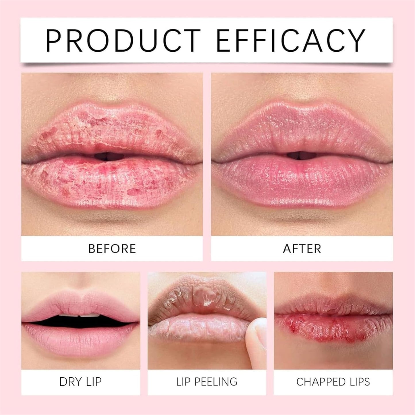 ODEIUN™  Naturally Fuller Lips|et Naturally Plump, Kissable Lips – No Injections Needed! 💋