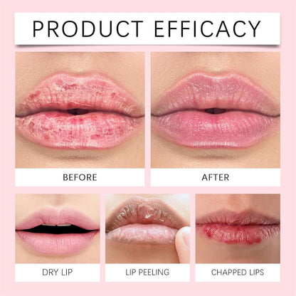 ODEIUN™  Naturally Fuller Lips|et Naturally Plump, Kissable Lips – No Injections Needed! 💋