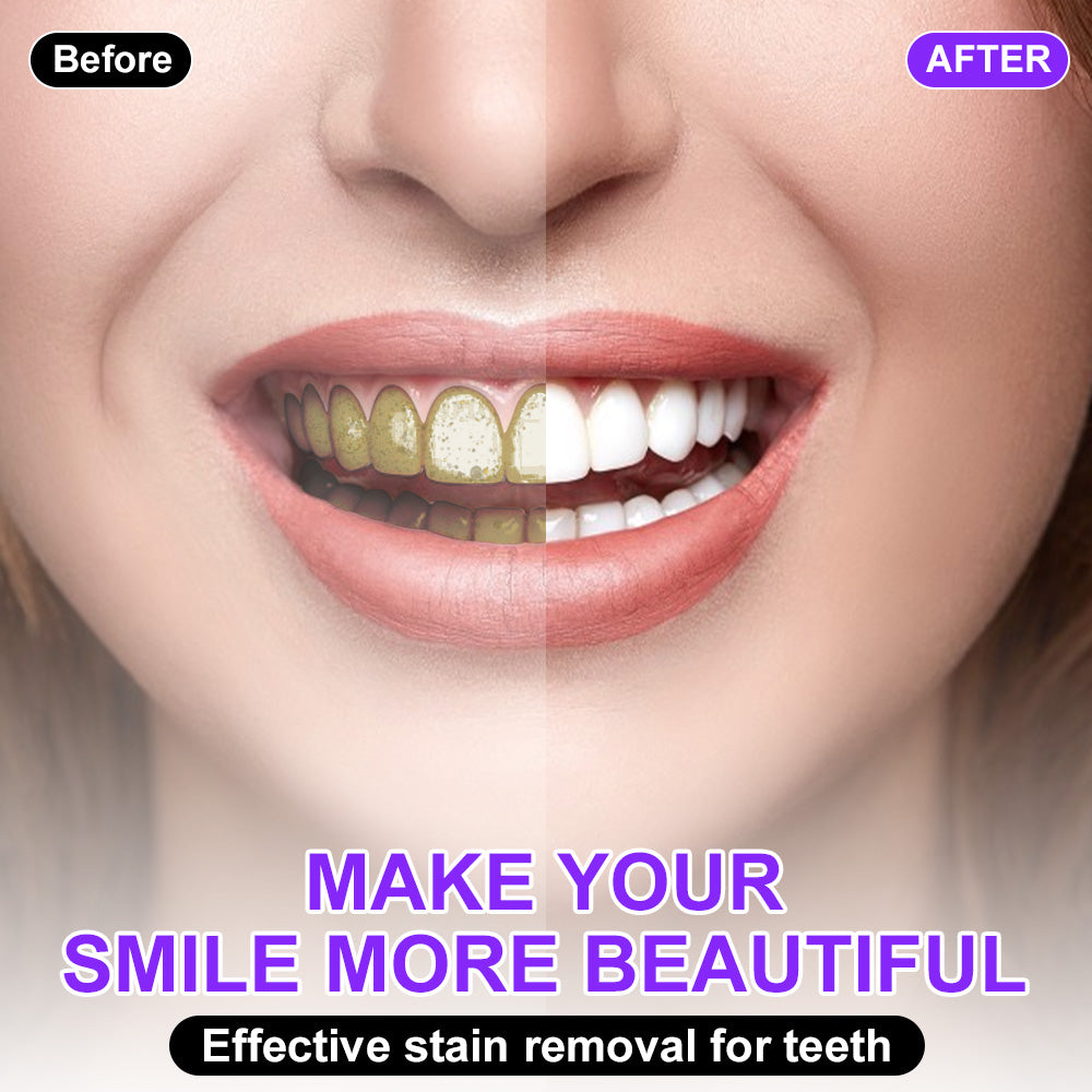 💫🦷𝐒𝐆𝐒 𝐔𝐊 𝐓𝐞𝐬𝐭𝐞𝐝 | 𝐅𝐥𝐲𝐬𝐦𝐮𝐬® 𝐂𝐨𝐥𝐨𝐮𝐫 𝐂𝐨𝐫𝐫𝐞𝐜𝐭𝐨𝐫 𝐒𝐞𝐫𝐮𝐦 — Clinically proven to gently remove stains, whiten teeth, and restore natural brightness in just 3 days — safe for sensitive teeth and enamel