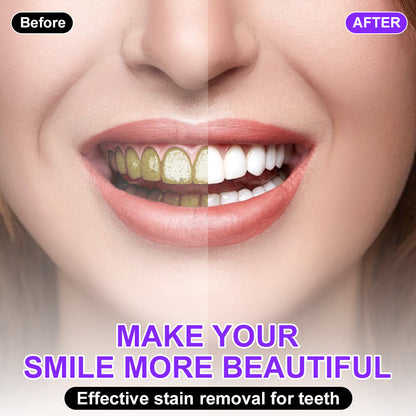 💫🦷𝐒𝐆𝐒 𝐔𝐊 𝐓𝐞𝐬𝐭𝐞𝐝 | 𝐅𝐥𝐲𝐬𝐦𝐮𝐬® 𝐂𝐨𝐥𝐨𝐮𝐫 𝐂𝐨𝐫𝐫𝐞𝐜𝐭𝐨𝐫 𝐒𝐞𝐫𝐮𝐦 — Clinically proven to gently remove stains, whiten teeth, and restore natural brightness in just 3 days — safe for sensitive teeth and enamel