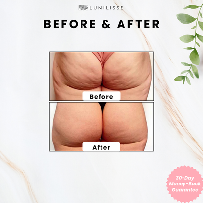Negusy™ GlowSculpt Body Gua Sha|Glow from Within ✨ Define, Detox & Lift Your Body 💆‍♀️