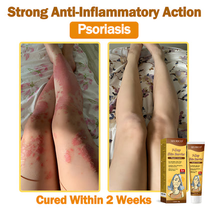🔥Limited Time Offer-Seurico™ 7-Day Skin Barrier Repair Cream -Sensitive Skin Emergency Fix – 72h Calming + 7-Day Barrier Repair ✅US Dermatologist Approved