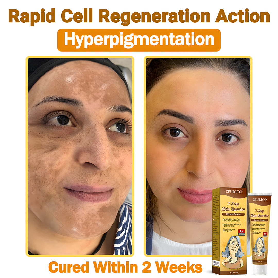 🔥Limited Time Offer-Seurico™ 7-Day Skin Barrier Repair Cream -Sensitive Skin Emergency Fix – 72h Calming + 7-Day Barrier Repair ✅US Dermatologist Approved