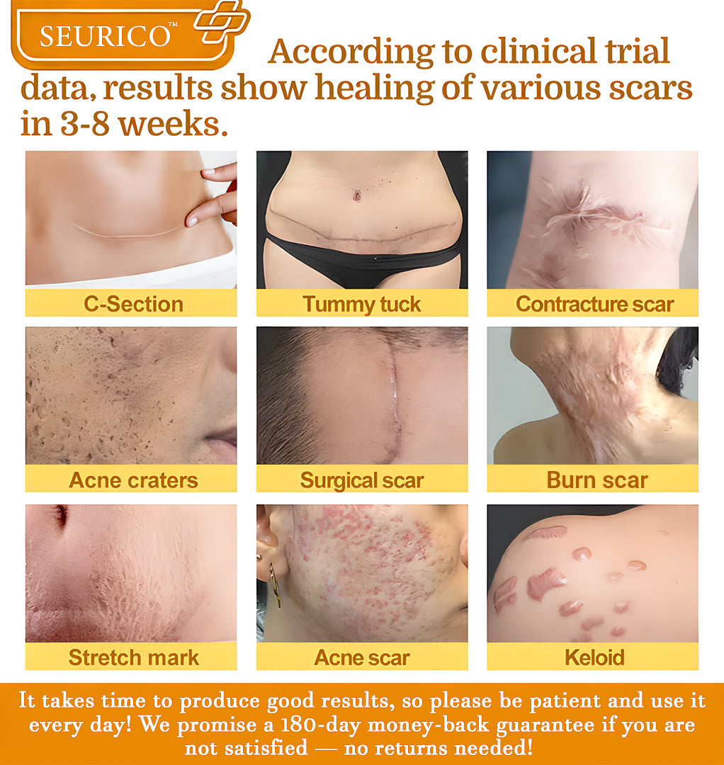 🔥Limited Time Offer-Seurico™ 7-Day Skin Barrier Repair Cream -Sensitive Skin Emergency Fix – 72h Calming + 7-Day Barrier Repair ✅US Dermatologist Approved
