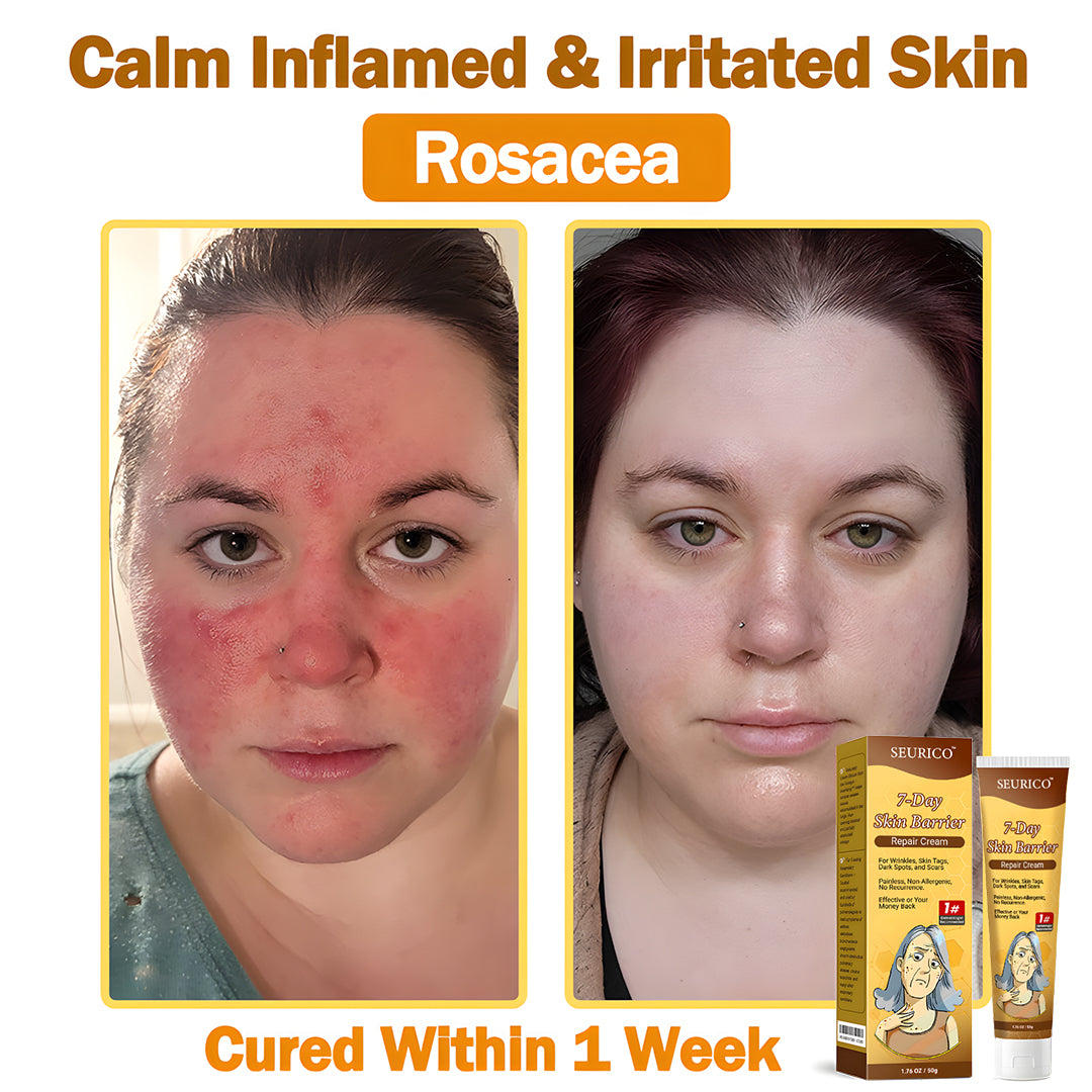 🔥Limited Time Offer-Seurico™ 7-Day Skin Barrier Repair Cream -Sensitive Skin Emergency Fix – 72h Calming + 7-Day Barrier Repair ✅US Dermatologist Approved