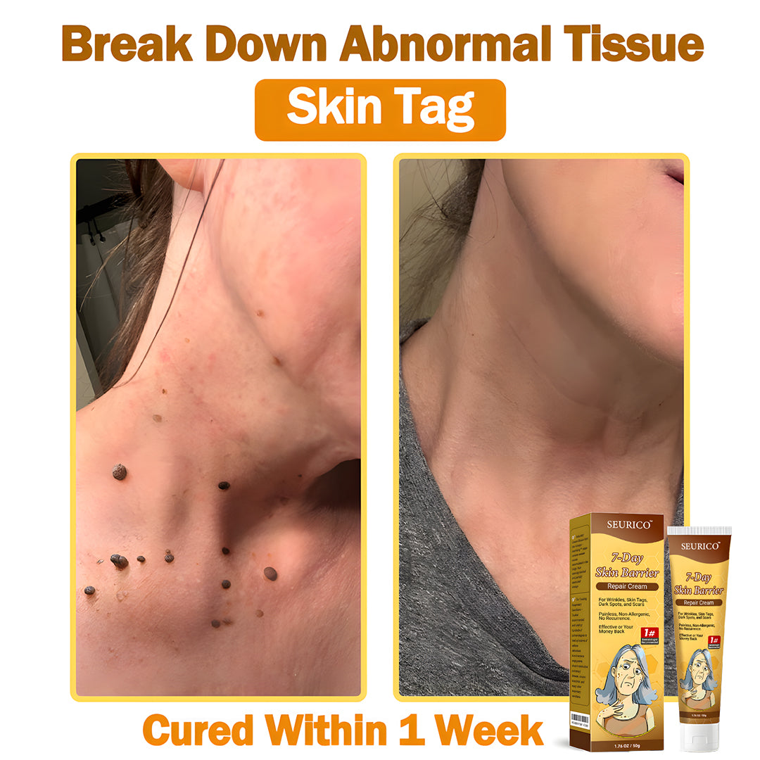🔥Limited Time Offer-Seurico™ 7-Day Skin Barrier Repair Cream -Sensitive Skin Emergency Fix – 72h Calming + 7-Day Barrier Repair ✅US Dermatologist Approved