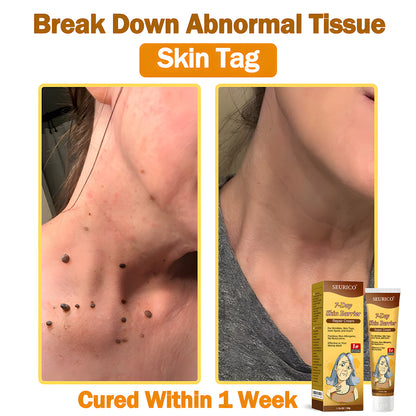 🔥Limited Time Offer-Seurico™ 7-Day Skin Barrier Repair Cream -Sensitive Skin Emergency Fix – 72h Calming + 7-Day Barrier Repair ✅US Dermatologist Approved