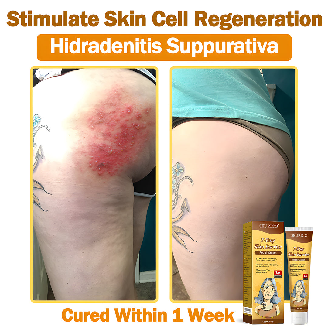 🔥Limited Time Offer-Seurico™ 7-Day Skin Barrier Repair Cream -Sensitive Skin Emergency Fix – 72h Calming + 7-Day Barrier Repair ✅US Dermatologist Approved