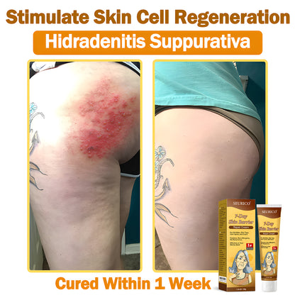 🔥Limited Time Offer-Seurico™ 7-Day Skin Barrier Repair Cream -Sensitive Skin Emergency Fix – 72h Calming + 7-Day Barrier Repair ✅US Dermatologist Approved