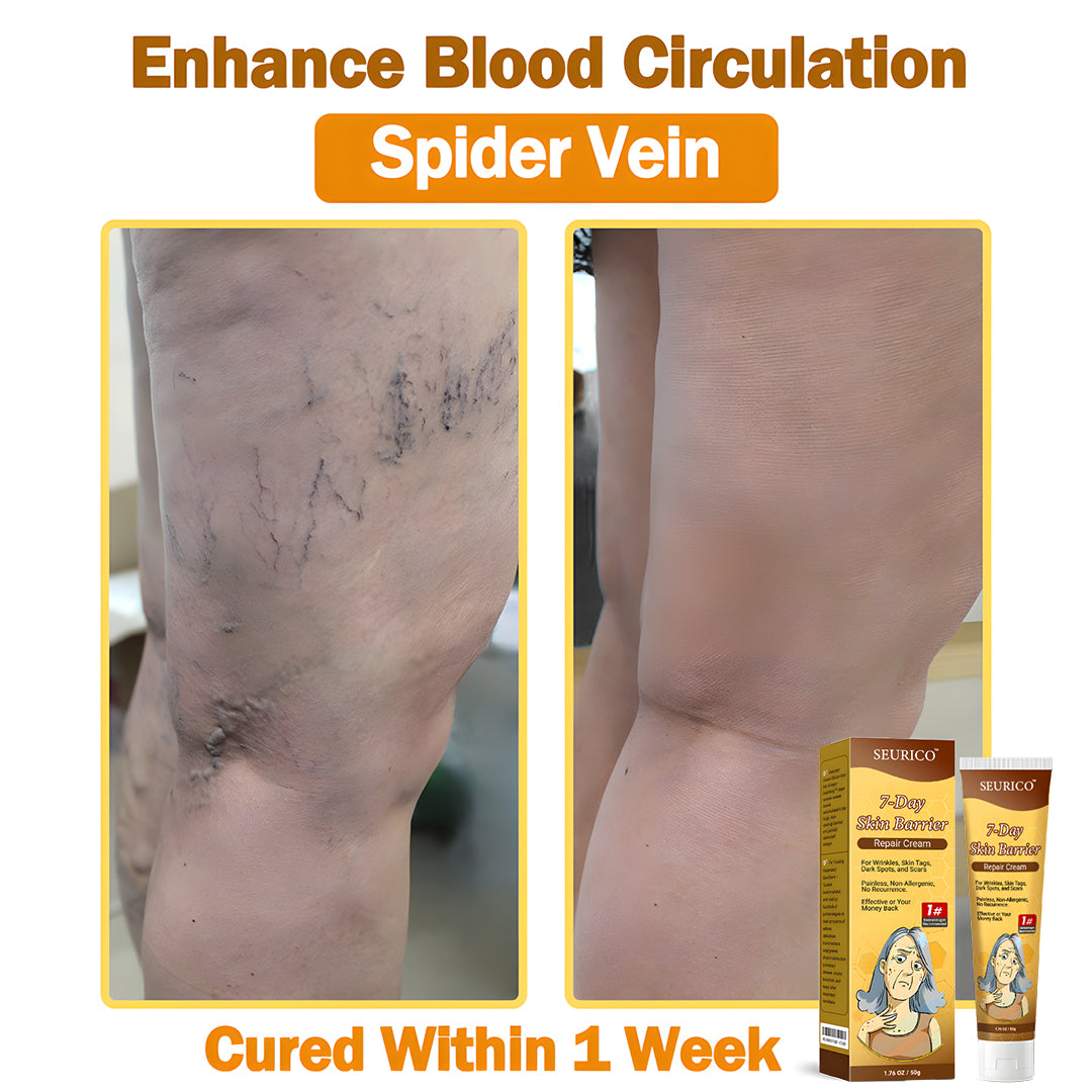 🔥Limited Time Offer-Seurico™ 7-Day Skin Barrier Repair Cream -Sensitive Skin Emergency Fix – 72h Calming + 7-Day Barrier Repair ✅US Dermatologist Approved
