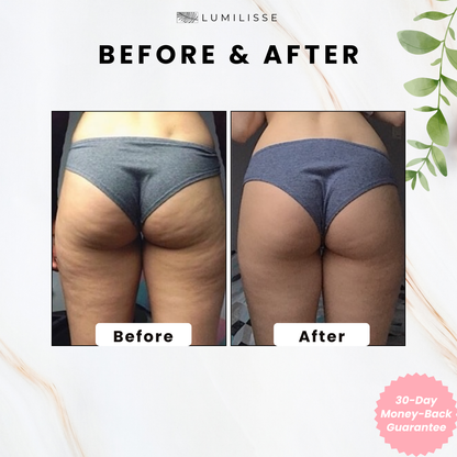 Negusy™ GlowSculpt Body Gua Sha|Glow from Within ✨ Define, Detox & Lift Your Body 💆‍♀️