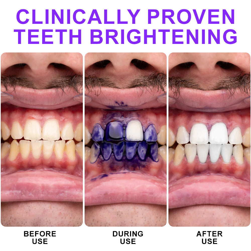 💫🦷𝐒𝐆𝐒 𝐔𝐊 𝐓𝐞𝐬𝐭𝐞𝐝 | 𝐅𝐥𝐲𝐬𝐦𝐮𝐬® 𝐂𝐨𝐥𝐨𝐮𝐫 𝐂𝐨𝐫𝐫𝐞𝐜𝐭𝐨𝐫 𝐒𝐞𝐫𝐮𝐦 — Clinically proven to gently remove stains, whiten teeth, and restore natural brightness in just 3 days — safe for sensitive teeth and enamel