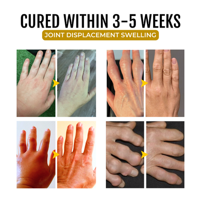 Seurico™ Turmeric & Emu Oil Joint Pain Relief Massage Gel
