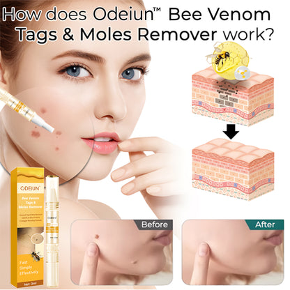ODEIUN™ Bee Venom Mole & Skin Tag Remover – Fast-Acting Formula for Clearer, Smoother Skin