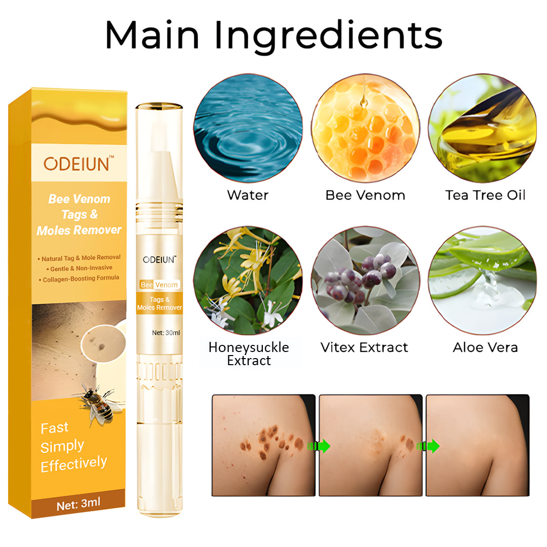 ODEIUN™ Bee Venom Mole & Skin Tag Remover – Fast-Acting Formula for Clearer, Smoother Skin