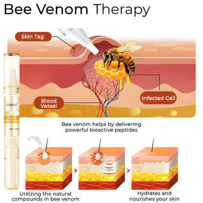 ODEIUN™ Bee Venom Mole & Skin Tag Remover – Fast-Acting Formula for Clearer, Smoother Skin