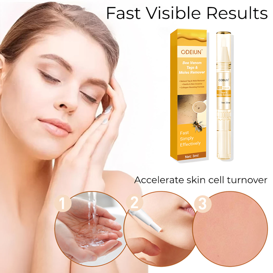 ODEIUN™ Bee Venom Mole & Skin Tag Remover – Fast-Acting Formula for Clearer, Smoother Skin