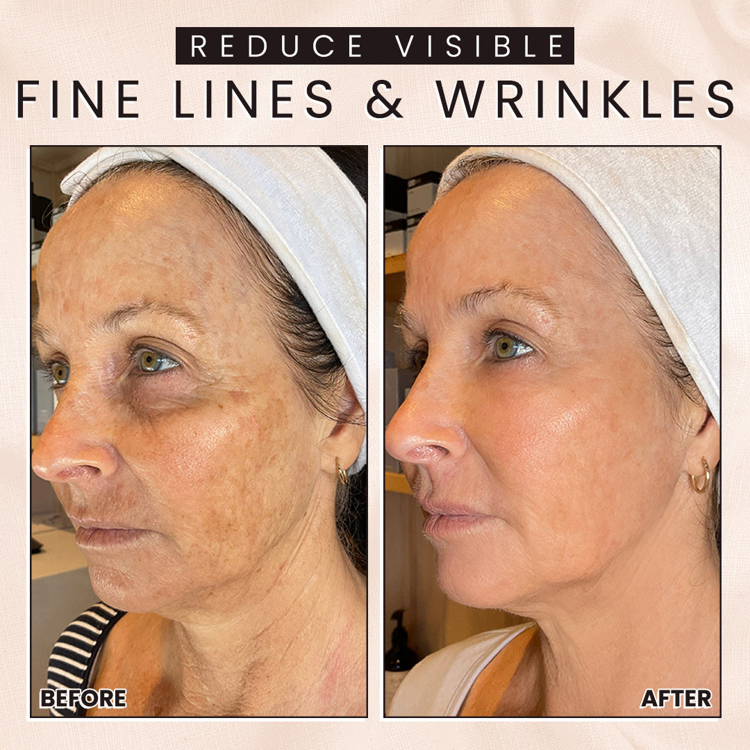 💧 Instant Face Tightener No-Filter Primer (🎁Includes FREE Application Brush!)