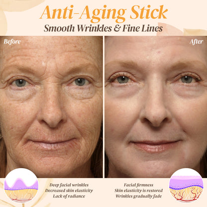 Seurico™ Bee Venom Wrinkle Lift Stick ✨ Smooth, Firm & Glow—Botox-Inspired Results Without the Injections