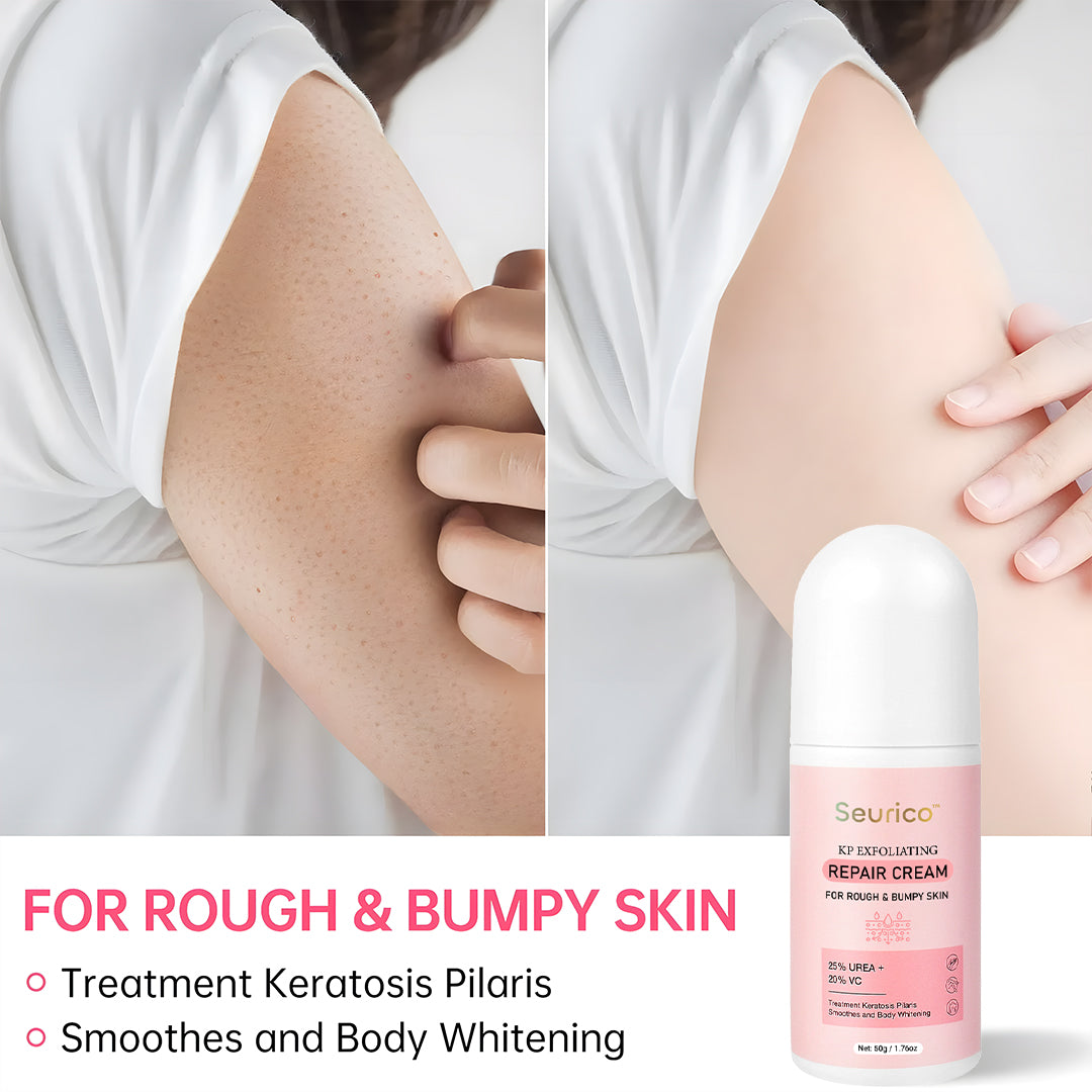 Seurico™ SmoothGlow KP Treatment Cream|Target Rough Bumps. Reveal Radiant, Touchably Smooth Skin. ✨💛