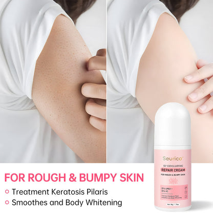 Seurico™ SmoothGlow KP Treatment Cream|Target Rough Bumps. Reveal Radiant, Touchably Smooth Skin. ✨💛