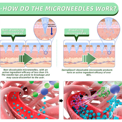 [See results in 7 days]🔥DermaGlyco® Transdermal GLP-1 Nano-Delivery Patch（Painless, long-lasting, addressing diabetes, obesity, and cardiovascular diseases）🌞