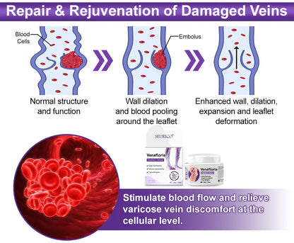 ✅𝐍𝐇𝐒-𝐀𝐏𝐏𝐑𝐎𝐕𝐄𝐃👨‍⚕️ Seurico™ Venafloria Essence Cream - Targets Vein Health, Swelling & Leg Cramps