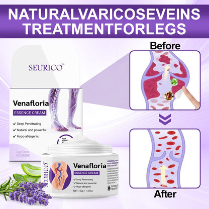 ✅𝐍𝐇𝐒-𝐀𝐏𝐏𝐑𝐎𝐕𝐄𝐃👨‍⚕️ Seurico™ Venafloria Essence Cream - Targets Vein Health, Swelling & Leg Cramps