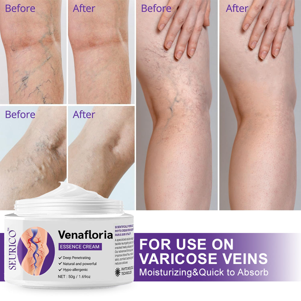 ✅𝐍𝐇𝐒-𝐀𝐏𝐏𝐑𝐎𝐕𝐄𝐃👨‍⚕️ Seurico™ Venafloria Essence Cream - Targets Vein Health, Swelling & Leg Cramps