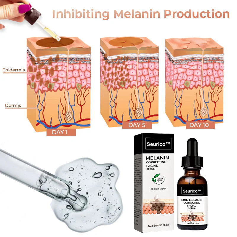 🔥 Hurry! Limited Time Offer!🔥 Fast Dark Spot Remover-Seurico™ Melanin Correcting Facial Serum