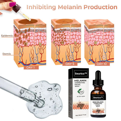 🔥 Hurry! Limited Time Offer!🔥 Fast Dark Spot Remover-Seurico™ Melanin Correcting Facial Serum