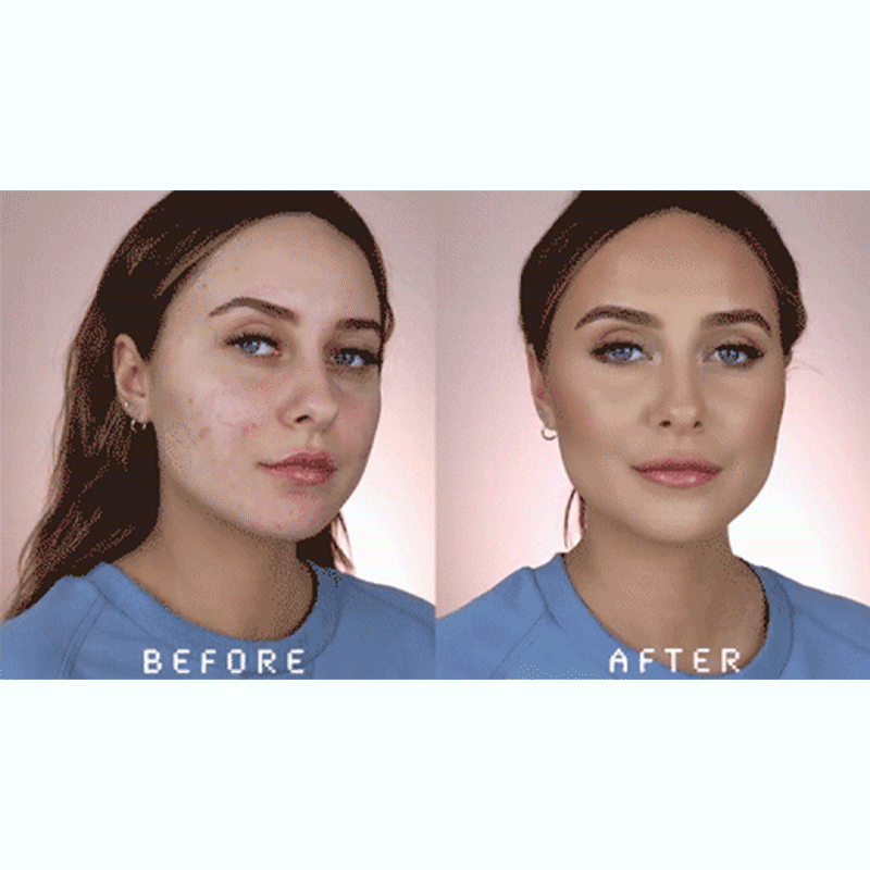 Seurico™  Botulin Bee Venom Wrinkle Removal cream- LAST DAY 75% OFF🔥