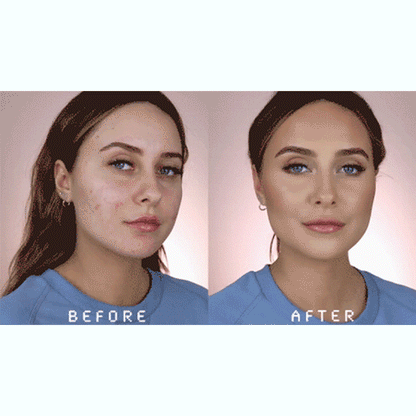 Seurico™  Botulin Bee Venom Wrinkle Removal cream- LAST DAY 75% OFF🔥