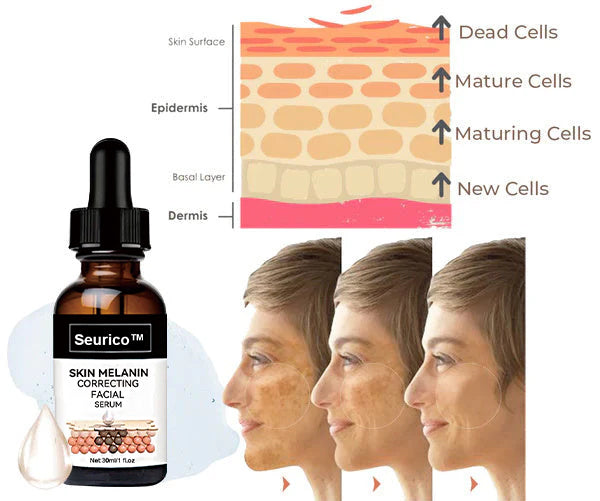 🔥 Hurry! Limited Time Offer!🔥 Fast Dark Spot Remover-Seurico™ Melanin Correcting Facial Serum