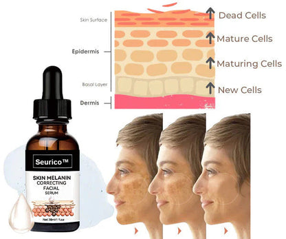 🔥 Hurry! Limited Time Offer!🔥 Fast Dark Spot Remover-Seurico™ Melanin Correcting Facial Serum