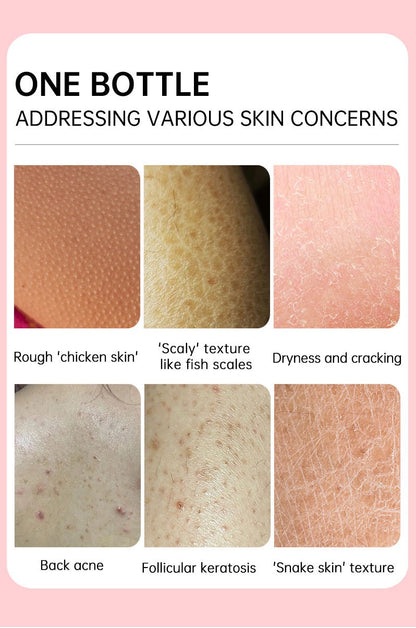 Seurico™ SmoothGlow KP Treatment Cream|Target Rough Bumps. Reveal Radiant, Touchably Smooth Skin. ✨💛