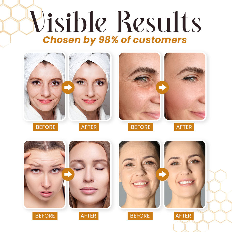 LBMLBM™ Botox Bee Venom Wrinkle Removal Cream