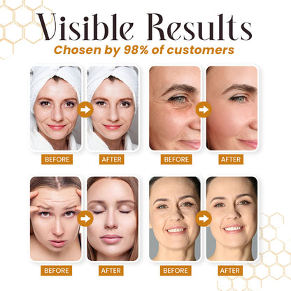 LBMLBM™ Botox Bee Venom Wrinkle Removal Cream