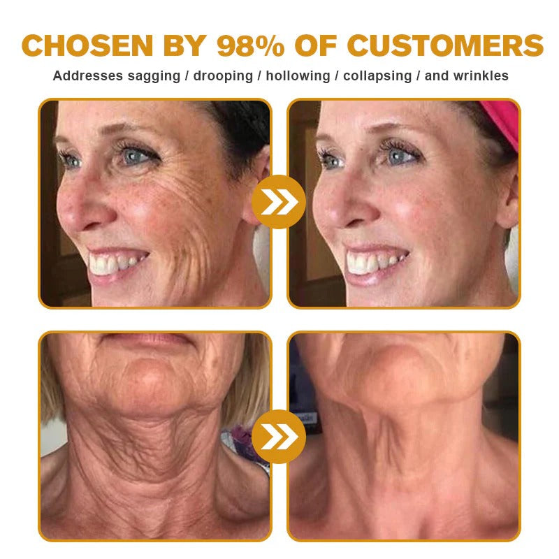 Seurico™  Botulin Bee Venom Wrinkle Removal cream- LAST DAY 75% OFF🔥