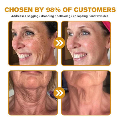 Seurico™  Botulin Bee Venom Wrinkle Removal cream- LAST DAY 75% OFF🔥