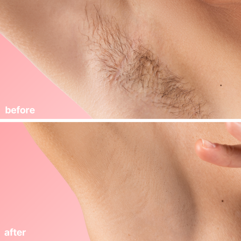 [Official Store]Seurico™ No-Blade Hair Removal Cream– Blade-Free, Fuss-Free, Flawless💗