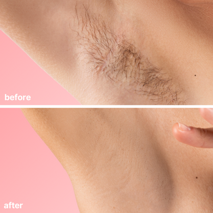 [Official Store]Seurico™ No-Blade Hair Removal Cream– Blade-Free, Fuss-Free, Flawless💗