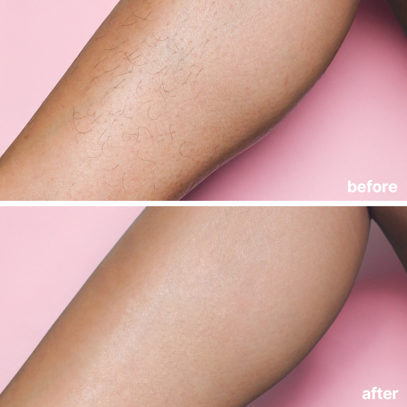 [Official Store]Seurico™ No-Blade Hair Removal Cream– Blade-Free, Fuss-Free, Flawless💗